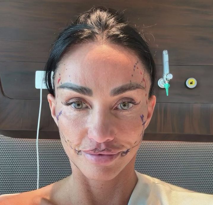 Katie Price in recovery from facelift